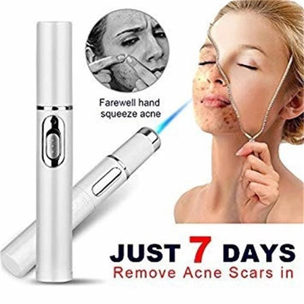 Blue Light Acne Therapy Pen – Laser Spot Treatment for Pimples, Scars & Wrinkles