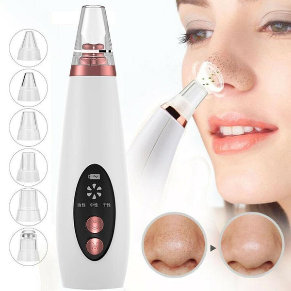 Blackhead Pore Vacuum Cleaner – Deep Cleansing Suction Tool for Acne, Oil & Blackhead Removal